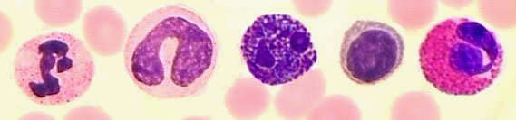 Αποτέλεσμα εικόνας για λεμφοκύτταρα